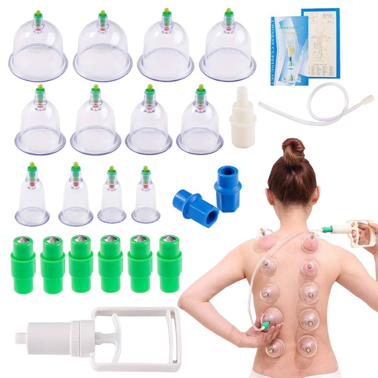 Cupping Therapy
